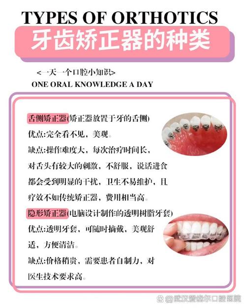 矫正牙齿该选哪种医院？公立私立怎么选？靠谱机构怎么判断？-图2
