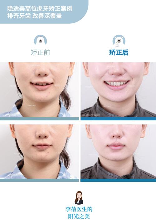 广州矫正牙齿哪里好？怎么选靠谱机构？-图1