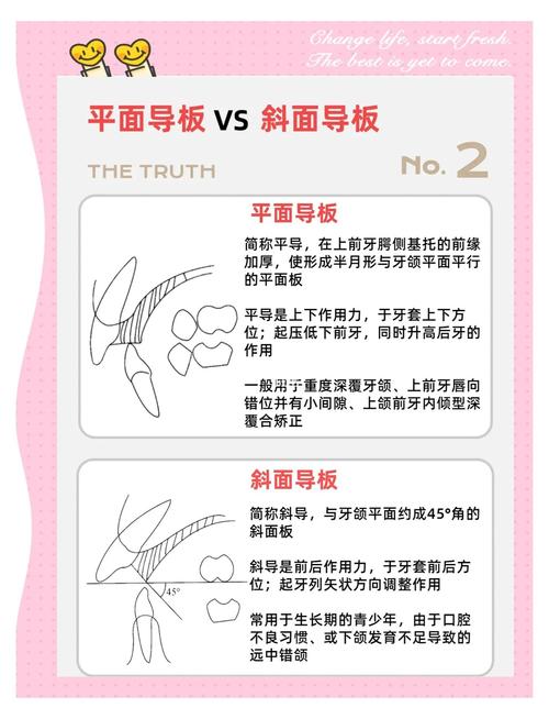 戴牙齿矫正导板说话会受影响吗？-图2