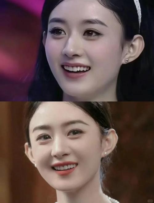 明星如何快速矫正牙齿？背后有哪些高效方法？-图1