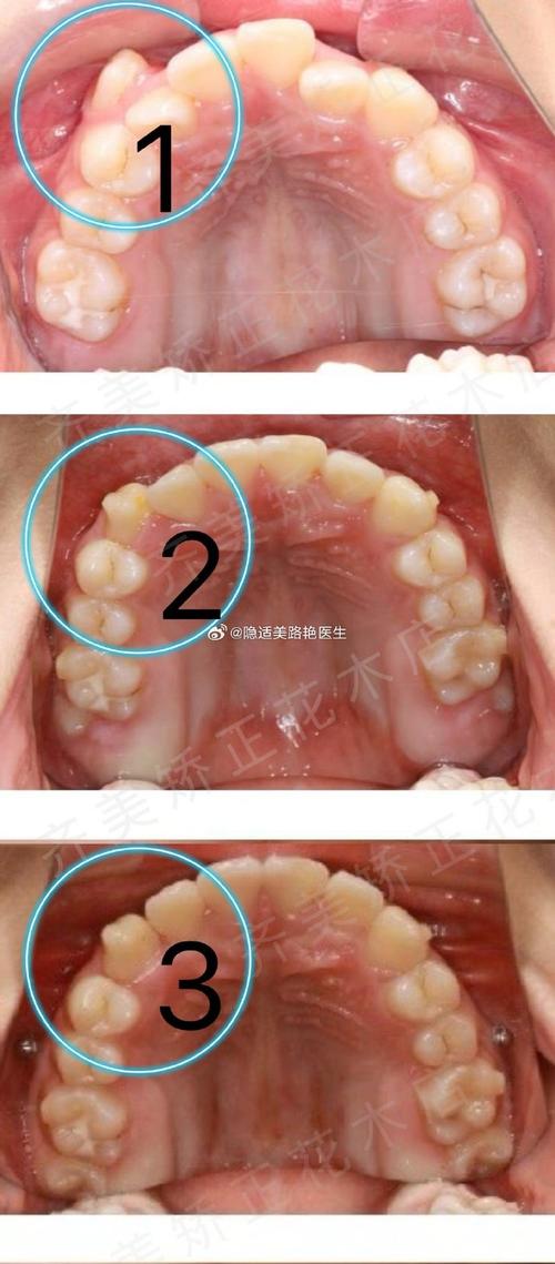 上海哪里可以矫正牙齿-图2 上海哪里可以矫正牙齿-图2