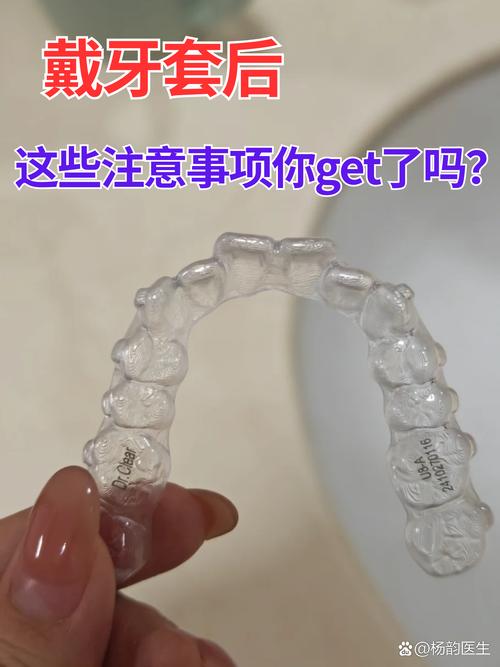 牙齿矫正必须戴牙套吗？还有其他矫正方式吗？-图3