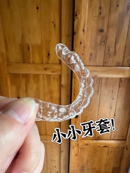 儿童牙齿功能性矫正器效果如何?适合哪些情况?-图2 儿童牙齿功能性矫正器效果如何?适合哪些情况?-图2