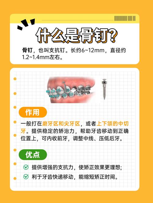 矫正牙齿打骨钉费用大概是多少？-图3