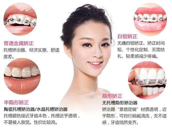 牙齿矫正真的能改变脸型吗?效果因人而异吗?-图2 牙齿矫正真的能改变脸型吗?效果因人而异吗?-图2