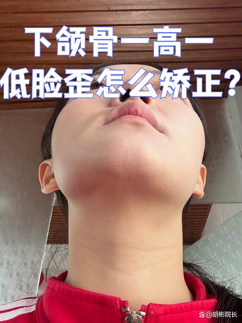 牙齿矫正会导致颧骨变高吗？-图2