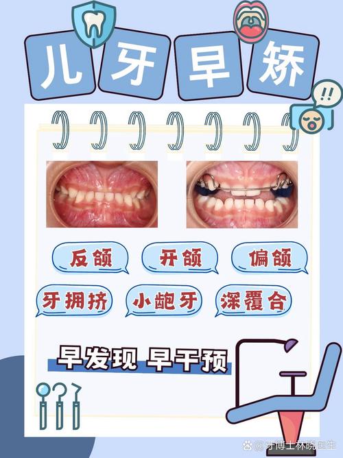 儿童牙齿矫正几岁最合适？-图2