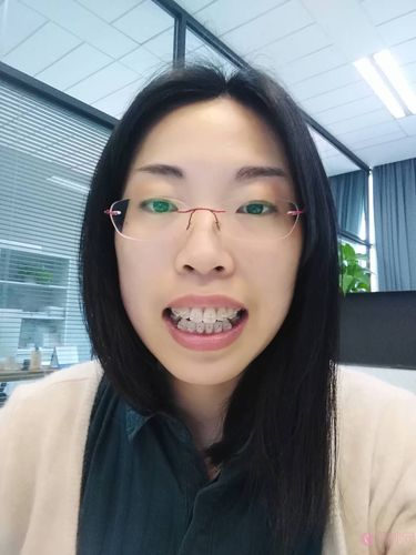 常州口腔医院矫正牙齿效果好不好?价格透明吗?值得选吗?-图1 常州口腔医院矫正牙齿效果好不好?价格透明吗?值得选吗?-图1