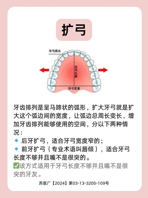 牙齿矫正时，该先拔牙还是先矫正？顺序如何确定？-图3