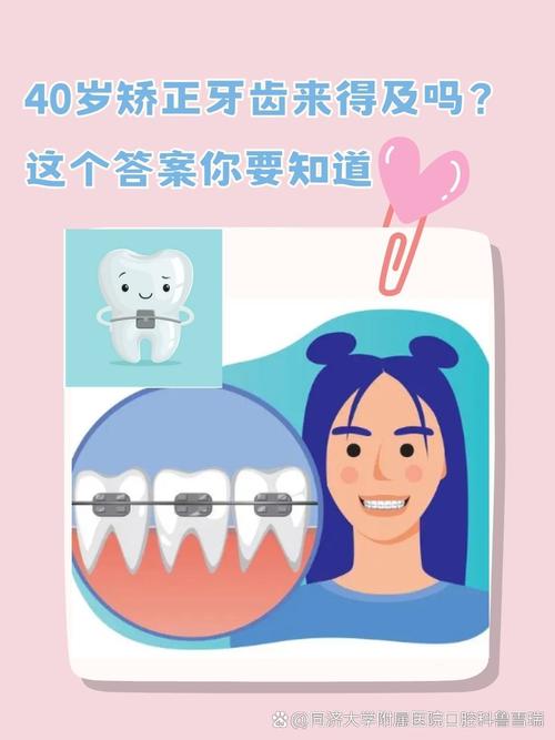 四十岁矫正牙齿可行吗？年龄会影响矫正效果吗？-图2