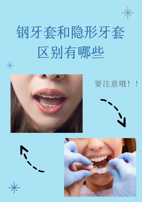 牙齿不想戴牙套，有哪些矫正方法可选？-图3