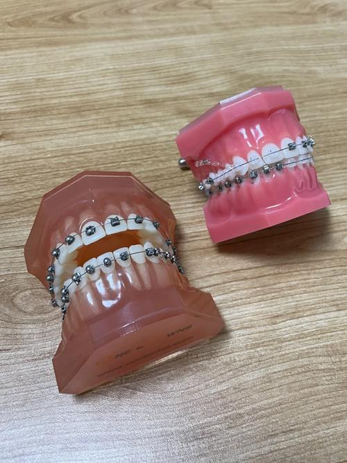 南京矫正牙齿医院排名哪家好？靠谱参考标准是什么？-图2