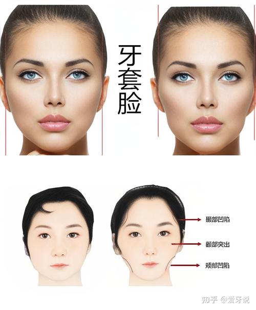 矫正牙齿能改变脸型吗？前后对比揭秘差异！-图2