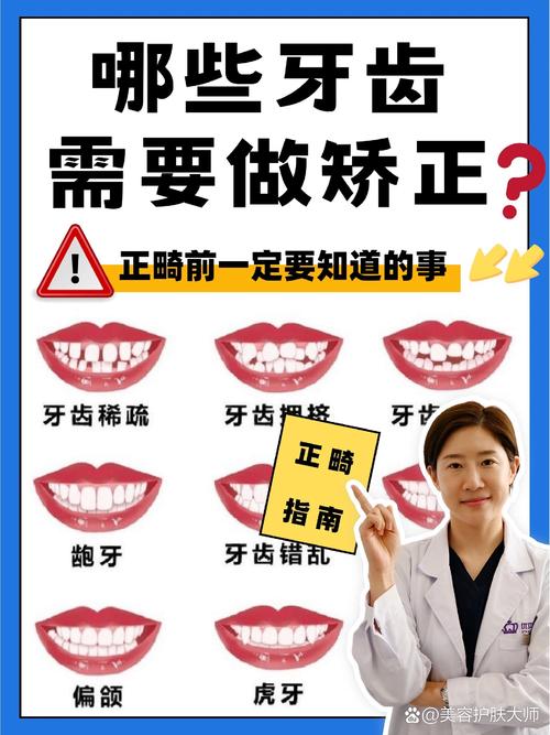 牙齿矫正后效果不佳，能做第二次矫正吗？-图3