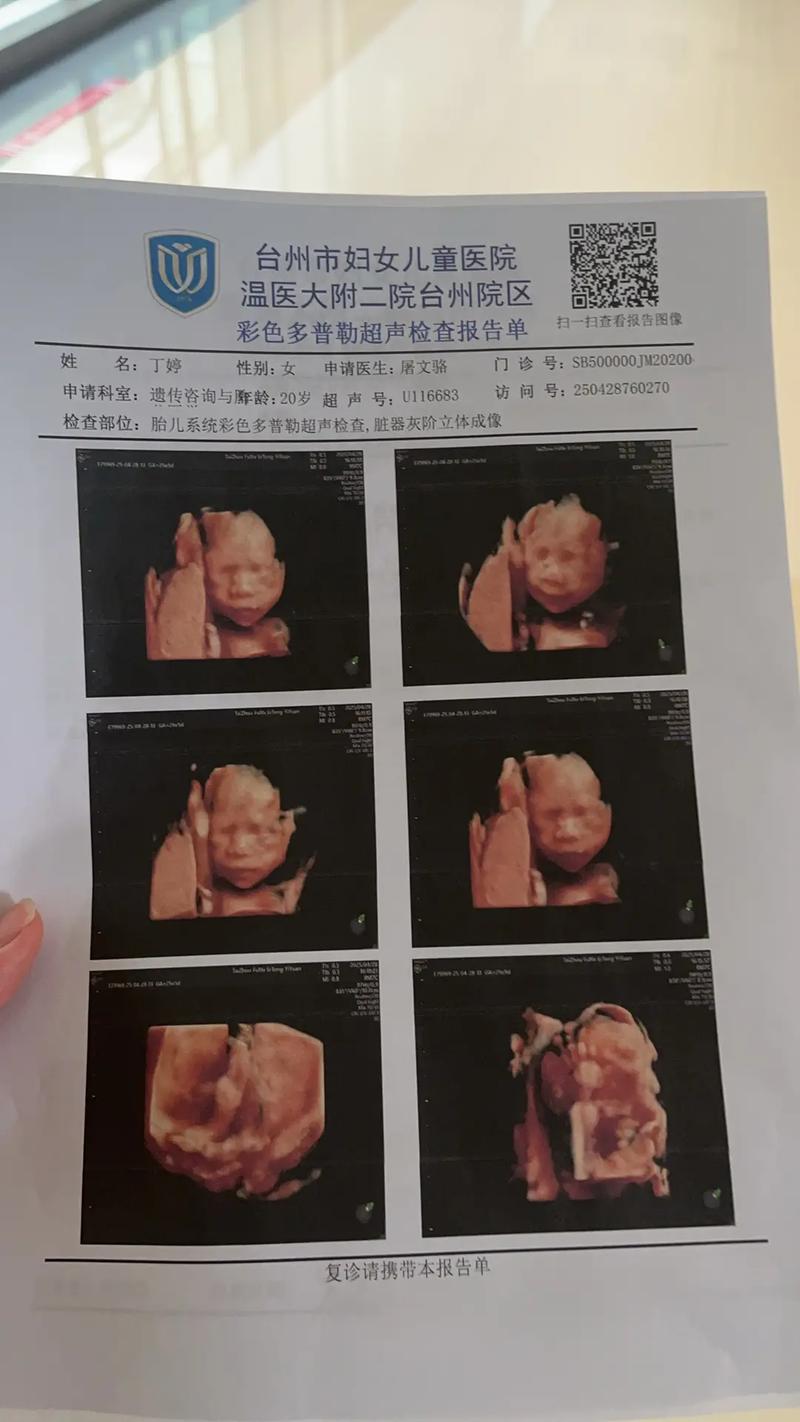 矫正一年后怀孕,牙齿矫正还能继续吗?-图3 矫正一年后怀孕,牙齿矫正还能继续吗?-图3