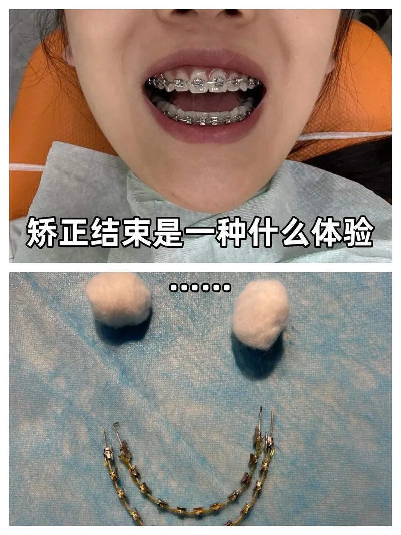 矫正一年后怀孕,牙齿矫正还能继续吗?-图2 矫正一年后怀孕,牙齿矫正还能继续吗?-图2