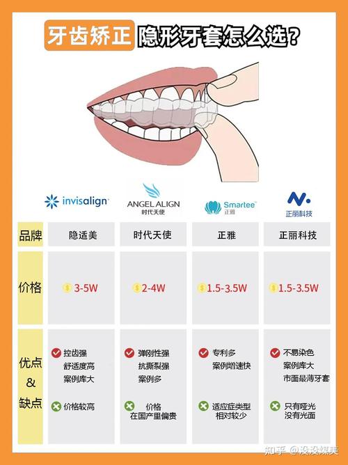 隐形矫正器费用为何差异大？关键影响因素有哪些？-图1
