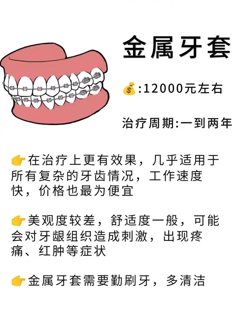 活动牙齿矫正器价格多少？性价比如何？-图3