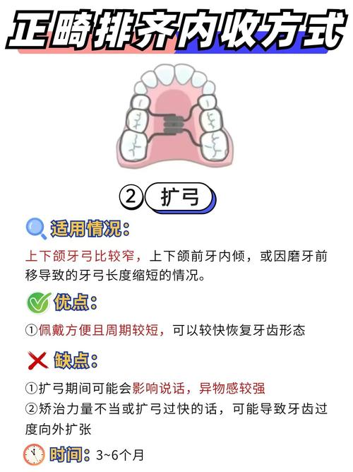 牙齿矫正的方法有几种-图2