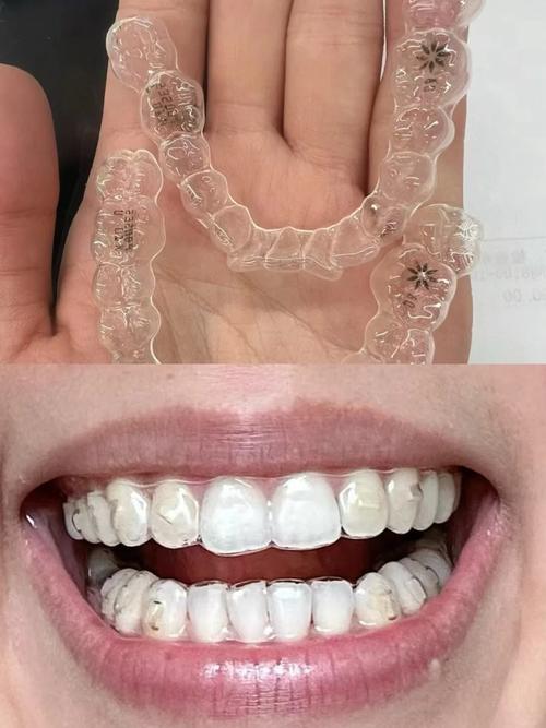 上海牙齿矫正哪里最好？求靠谱医院与医生推荐！-图1