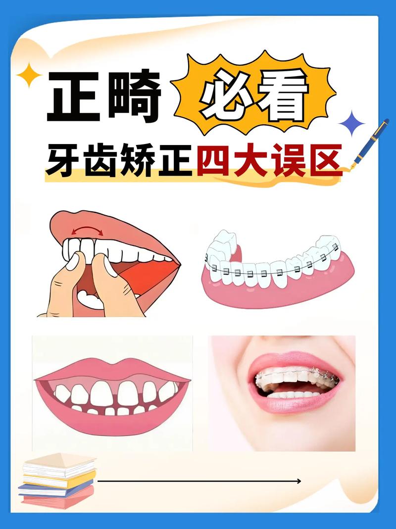 矫正牙齿能只矫一排吗-图1 矫正牙齿能只矫一排吗-图1