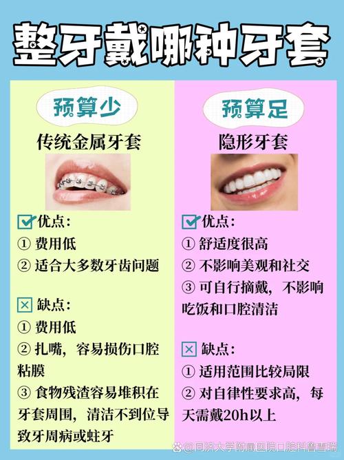 矫正牙齿一定要戴牙套？还有其他非牙套矫正方式吗？-图2