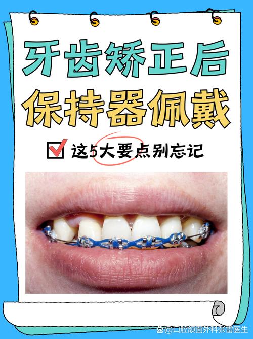 矫正后保持器要戴多久？不戴会反弹吗？-图2