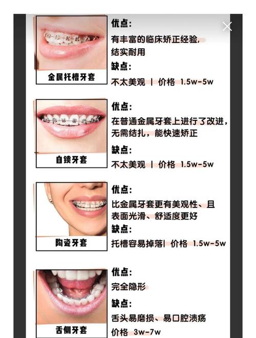 26岁矫正牙齿费用多少?成人矫正价格受哪些因素影响?-图3 26岁矫正牙齿费用多少?成人矫正价格受哪些因素影响?-图3