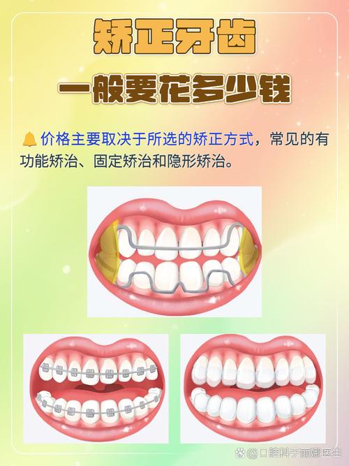 矫正牙齿费用受哪些因素影响?总共多少钱?-图3 矫正牙齿费用受哪些因素影响?总共多少钱?-图3