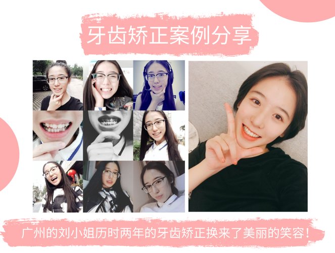 广州牙齿矫正哪家医院好？求靠谱推荐-图1