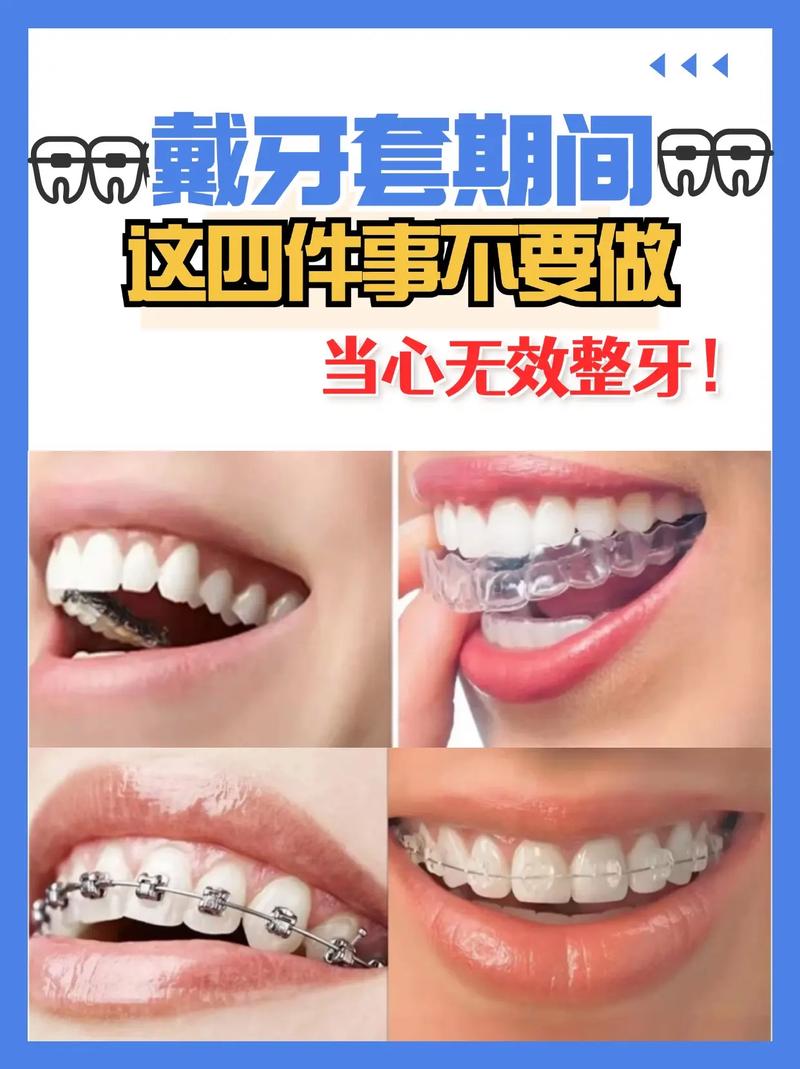 带牙套可以矫正牙齿吗-图3