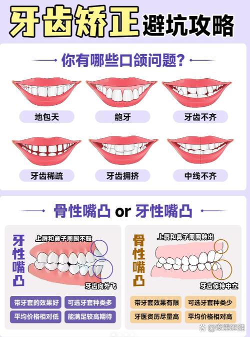 自锁托槽矫正牙齿，多大年龄做最合适？-图2