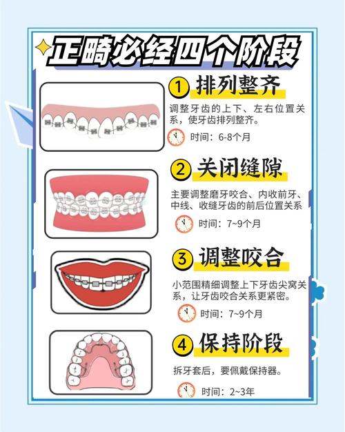 牙齿矫正的最佳时间是什么时候？多大年龄合适？-图3
