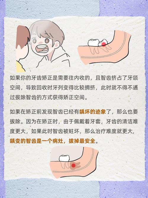 牙齿矫正需要拔牙吗》-图2