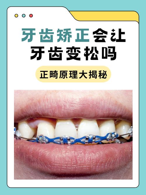 矫正牙齿为何会导致牙齿松动？-图1
