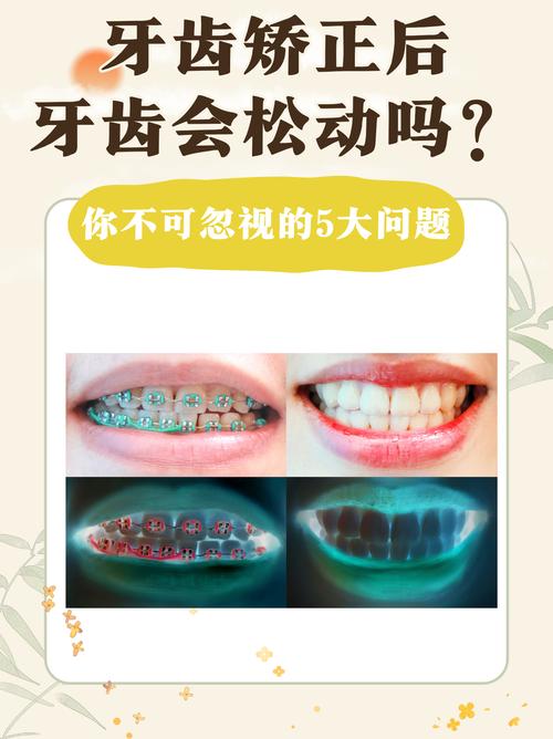 牙齿矫正后 牙齿松动-图3