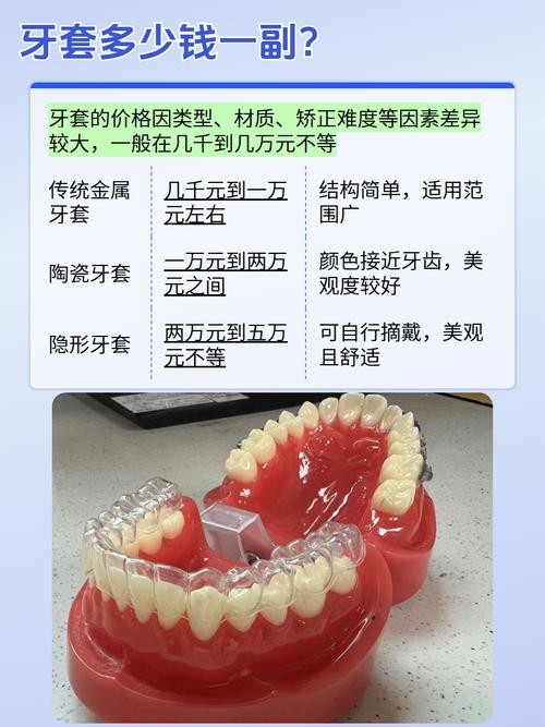 张家港牙齿矫正费用多少？附价格影响因素？-图3