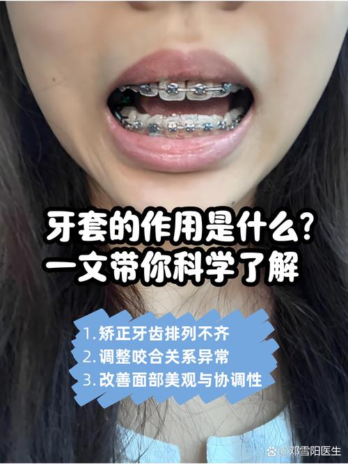 牙齿矫正为何会出现牙套脸？-图3