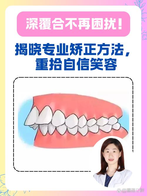 牙齿重叠错位怎么矫正？有哪些有效方法推荐？-图1