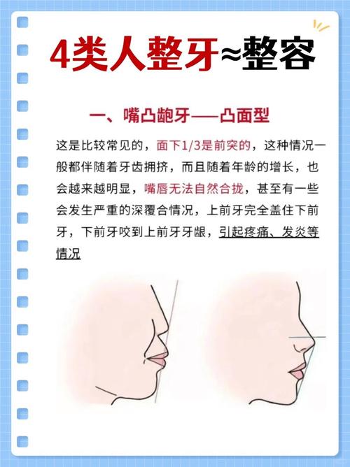 矫正牙齿真能改变脸型吗？效果如何？-图1