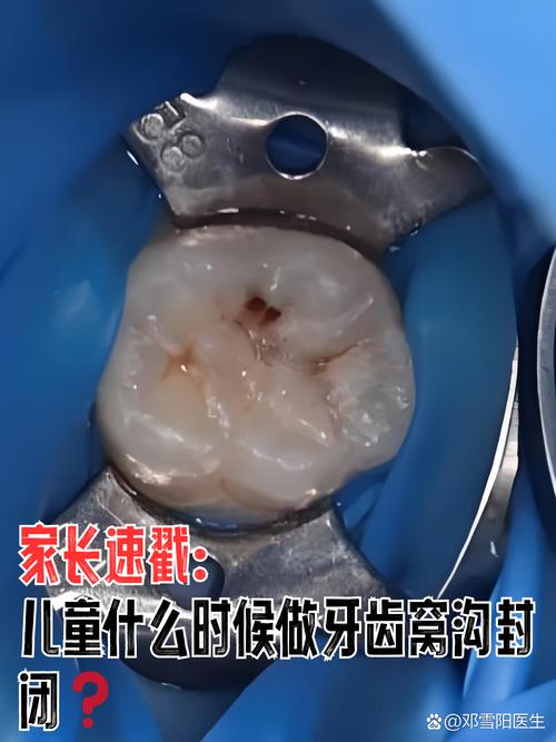 蛀牙很多能矫正牙齿吗-图1