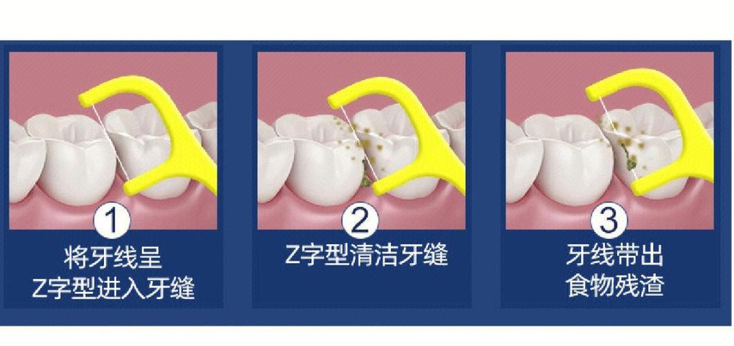 牙齿矫正中线不齐该怎么处理？-图1