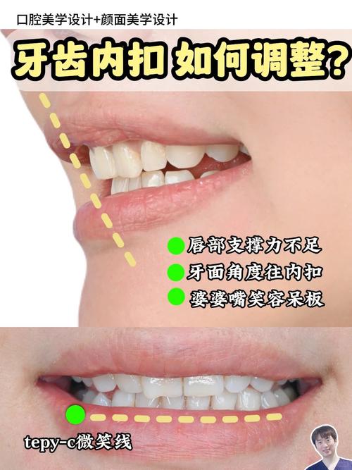 牙齿内凹也能矫正吗？矫正方法有哪些？效果如何？-图2
