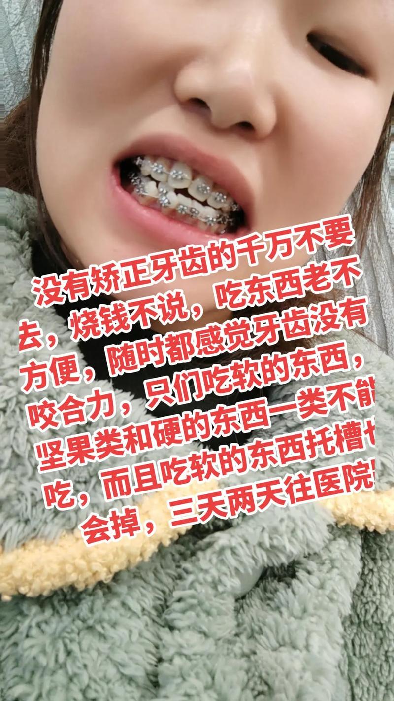 30岁矫正牙齿,真的会留下不可逆的后遗症吗?-图1 30岁矫正牙齿,真的会留下不可逆的后遗症吗?-图1