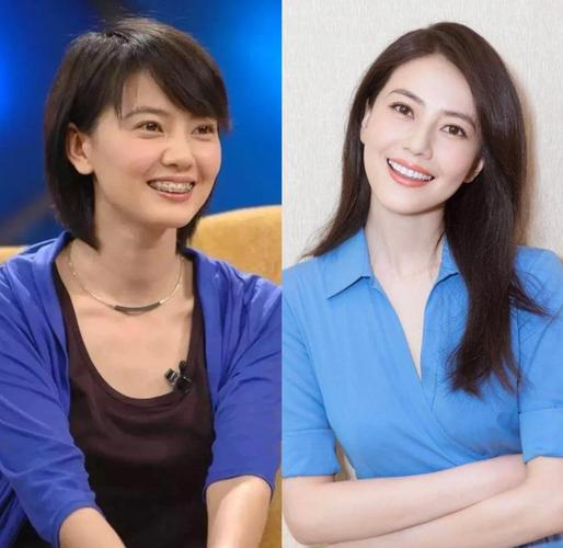 高圆圆27岁矫正牙齿，为何现在才整？-图1