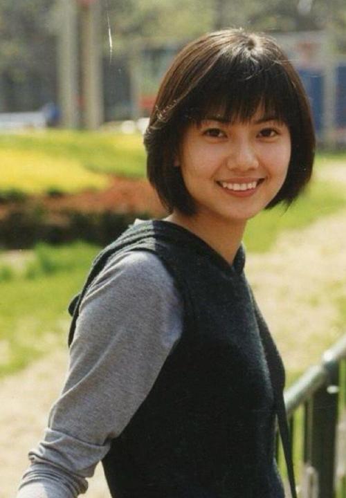 高圆圆27岁矫正牙齿，为何现在才整？-图2