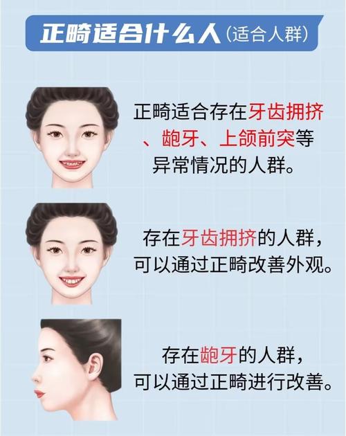 18岁矫正牙齿，矫正周期通常多久？-图3