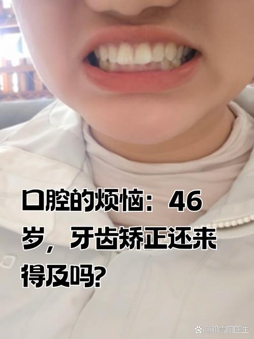 33岁矫正牙齿晚了吗？现在开始还来得及吗？-图2