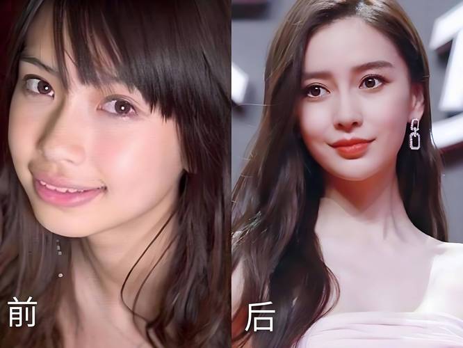 baby牙齿矫正图片能直观看出哪些矫正效果？-图1