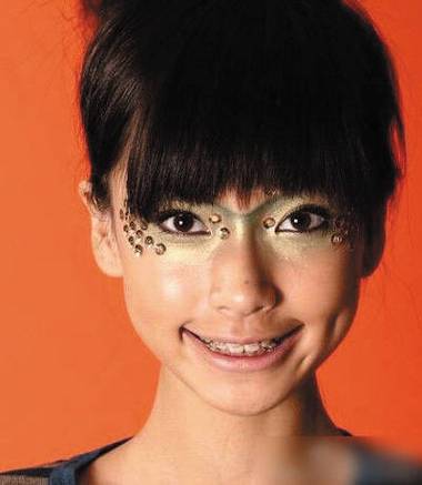 baby牙齿矫正图片能直观看出哪些矫正效果？-图2